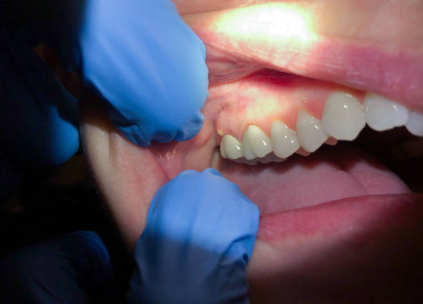Best Emergency Dentist for Special Needs Patients in Honsville, GA